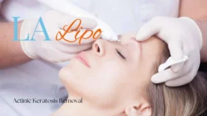 Woman receiving Actinic Keratosis Removal Treatment Melksham