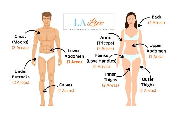 LA LIPO Cryolipolysis Areas Melksham