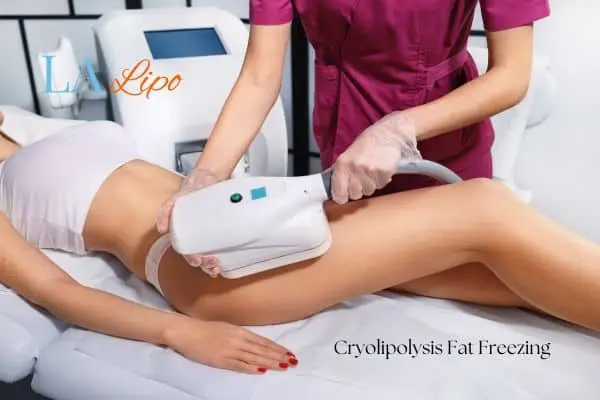 Woman receiving coolsculpting Melksham treatment on her thighs