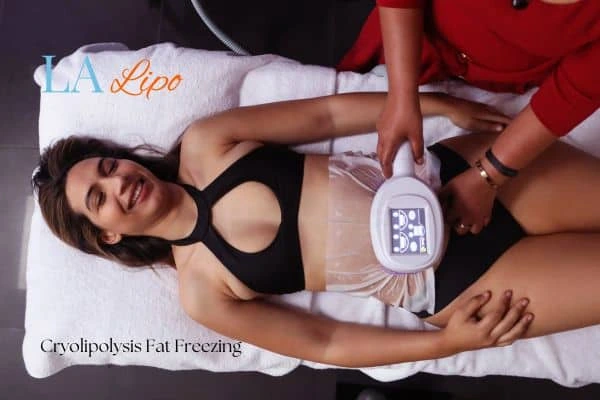 woman getting cryolipolysis Melksham