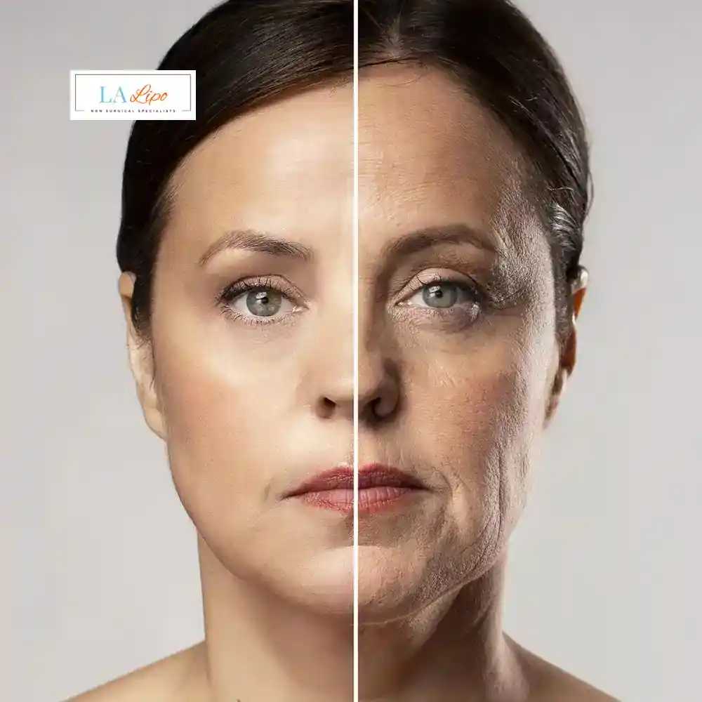 How Can You Tell If Non-Surgical Skin Tightening Is Right for You Melksham?