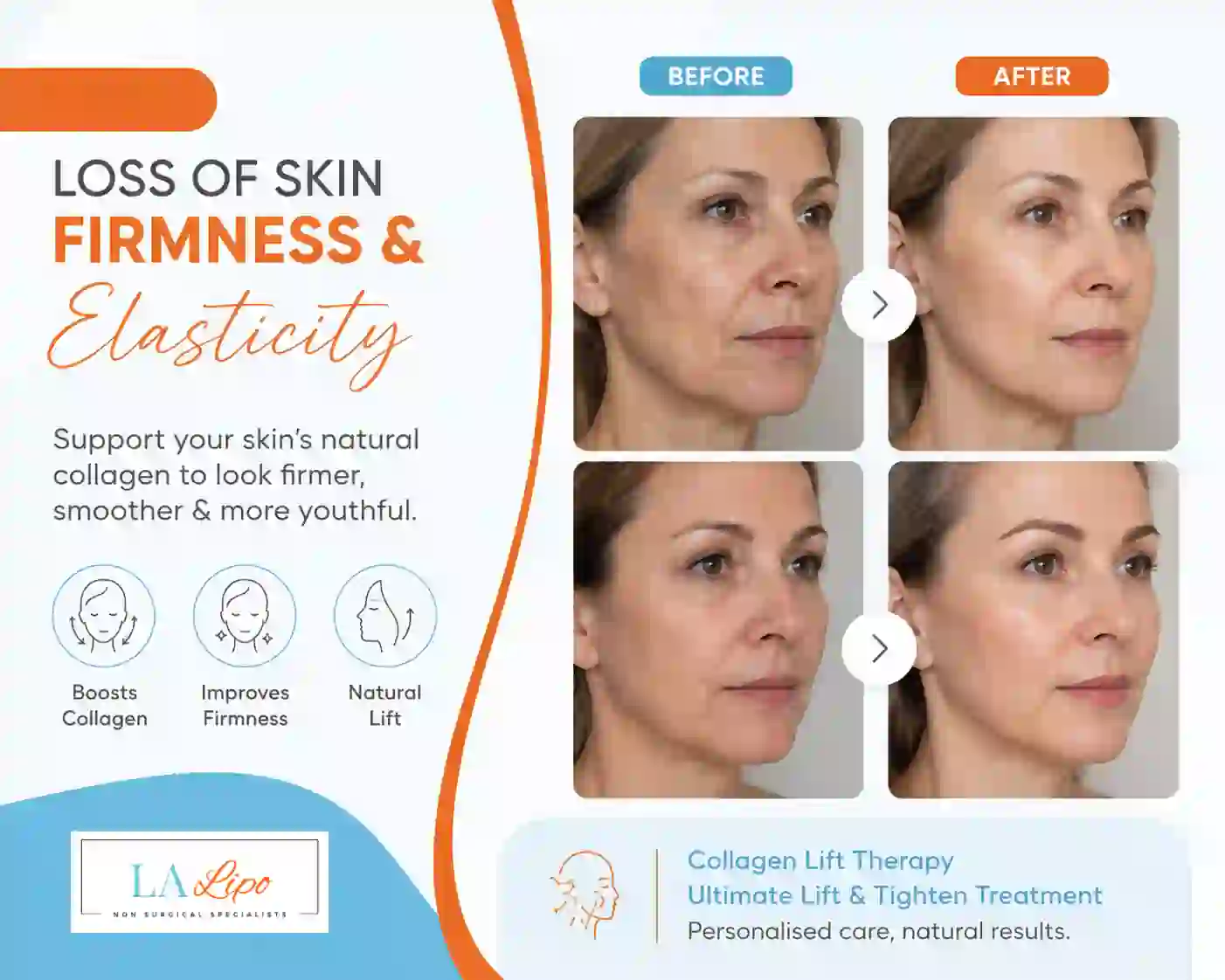 Sign #7: Loss of Skin Firmness and Elasticity Melksham