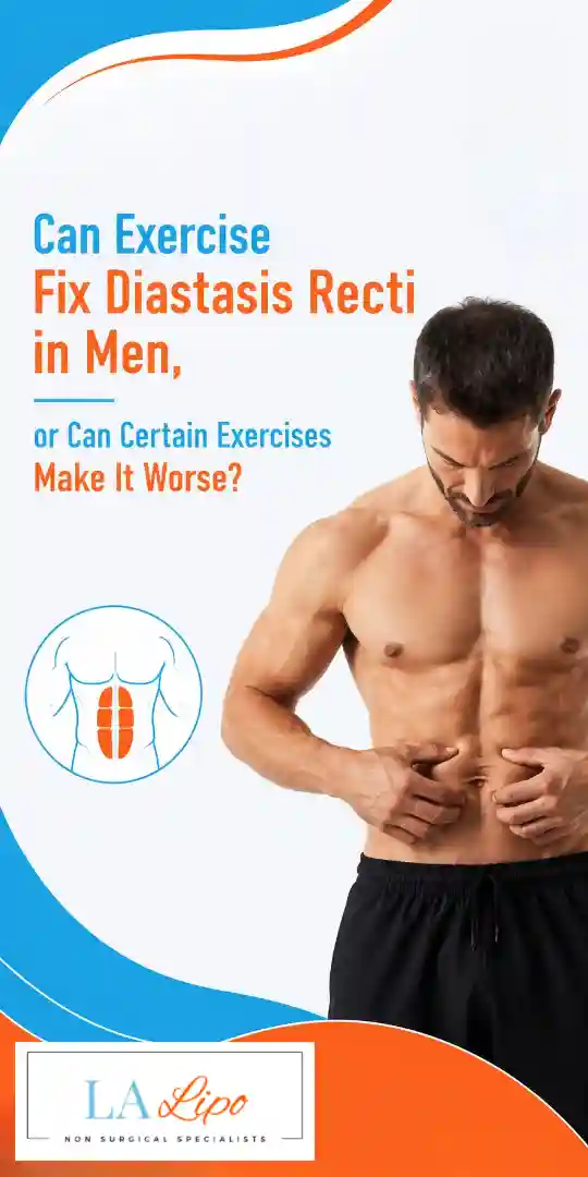 Can Exercise Fix Diastasis Recti in Men, or Can Certain Exercises Make It Worse Melksham?